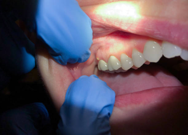 Best Emergency Gum Pain Relief  in Dennis Port, MA